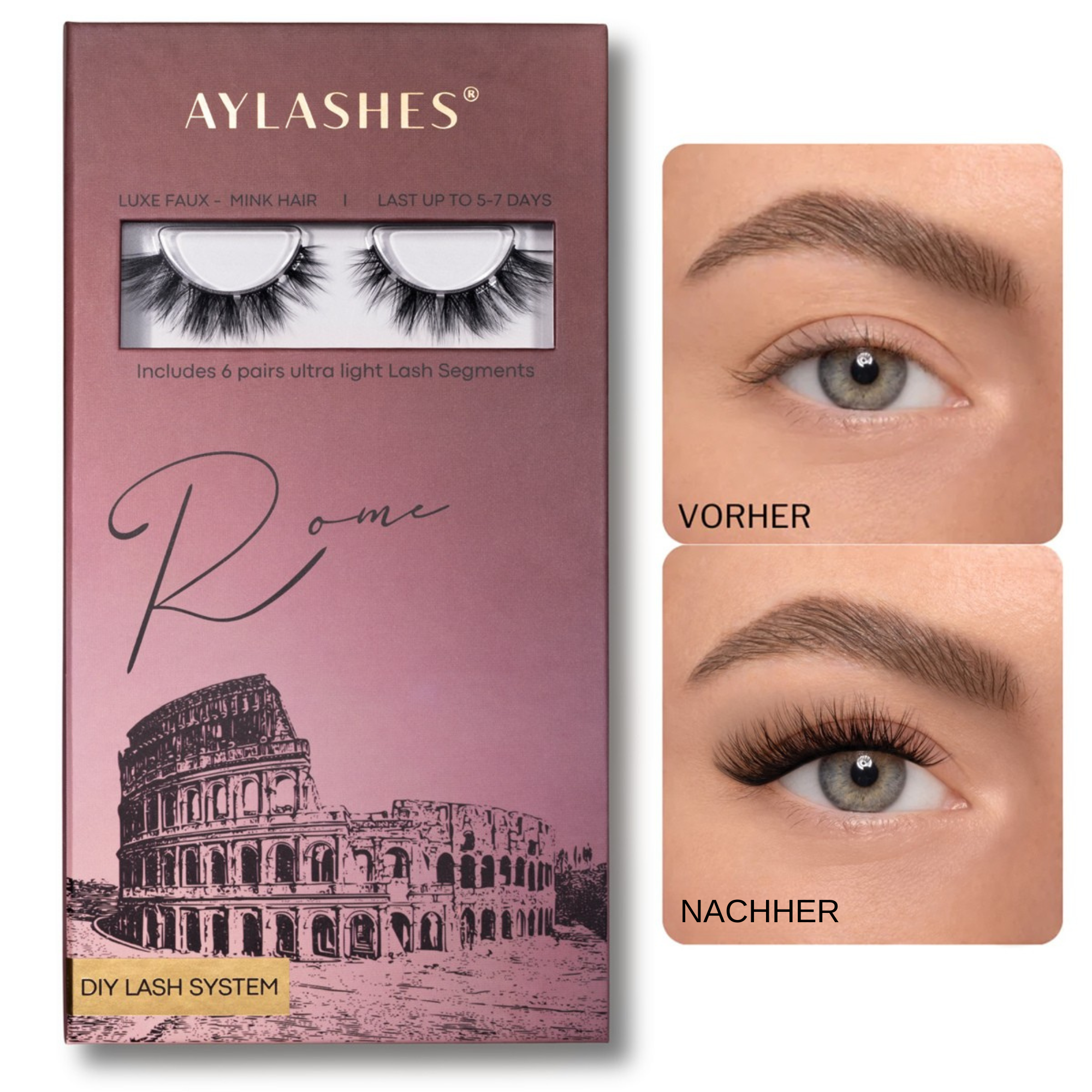 ROMA (5 mm - 16 mm)